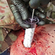 Image for article titled This Sponge-Filled Syringe Is Ready for the Battlefield